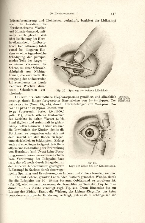 Die Augenerkrankungen im Kindesalter
